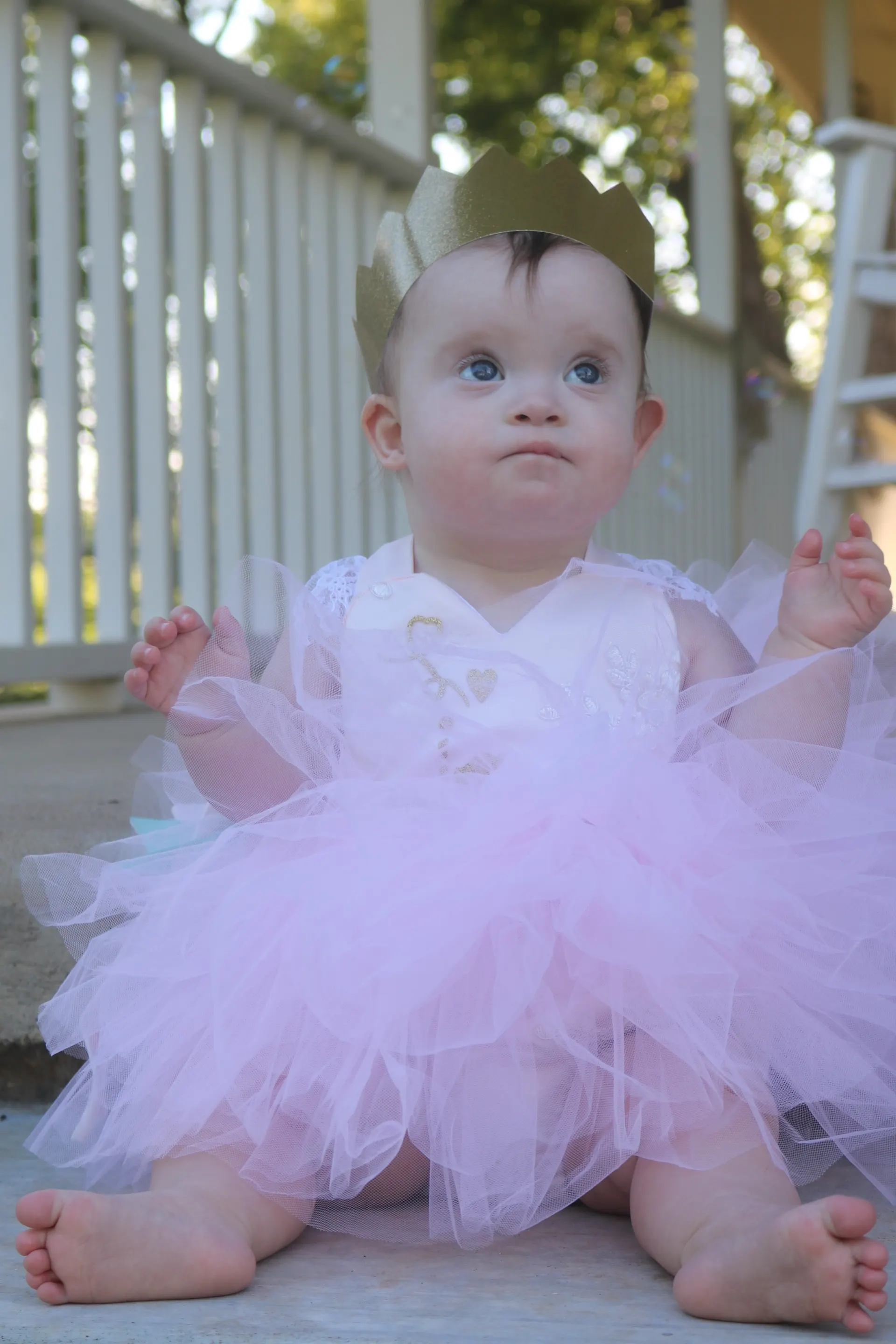 Beautiful Baby With Down Syndrome