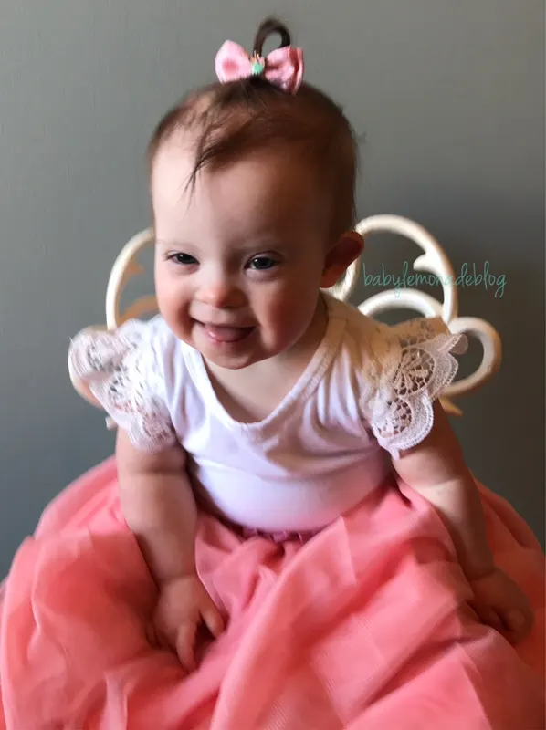 Down syndrome is beautiful