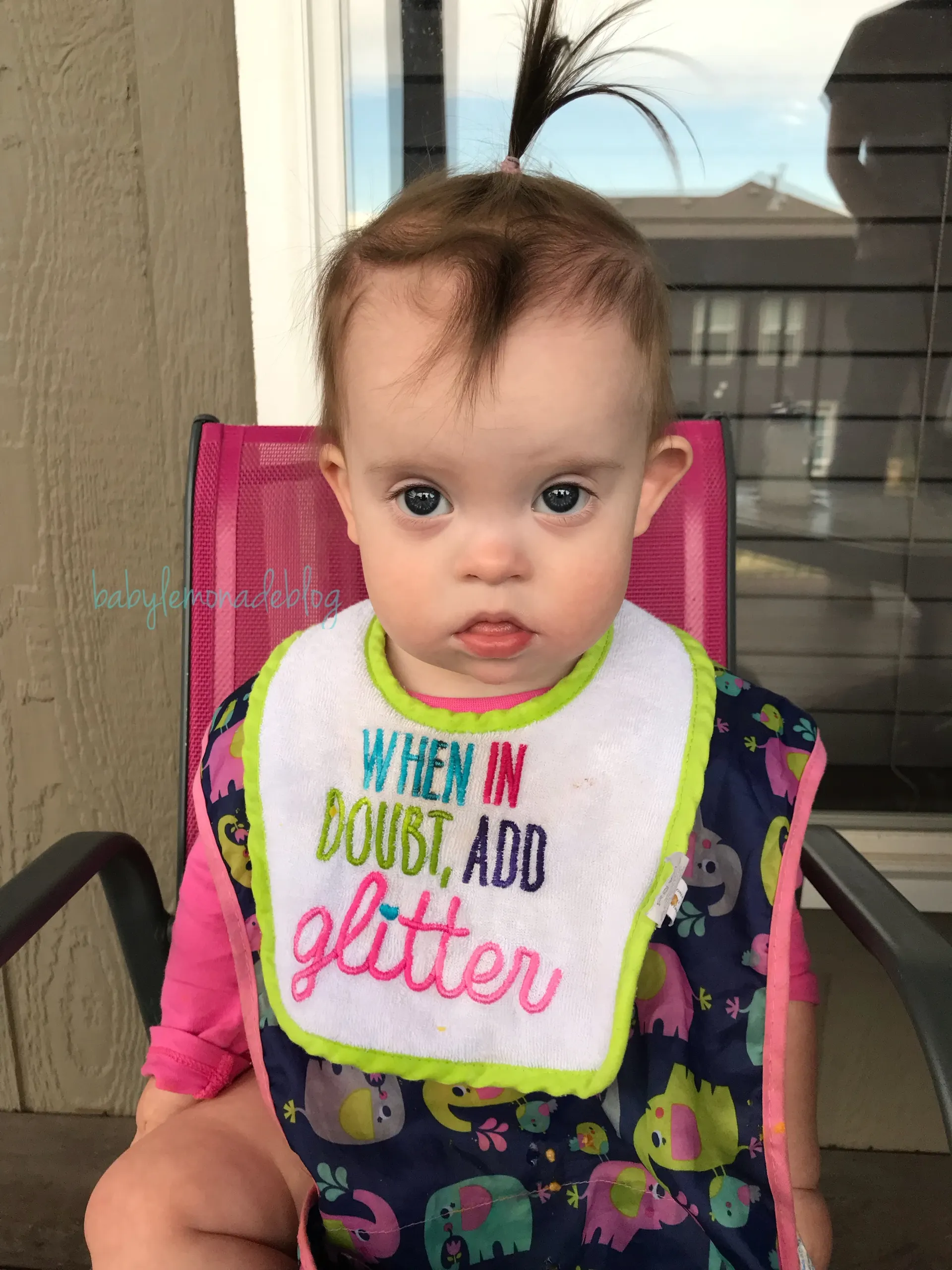 Down syndrome and optometry